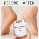 USB Powered Electric Foot Scrubber With 1 Replacement And 2 Speed Settings