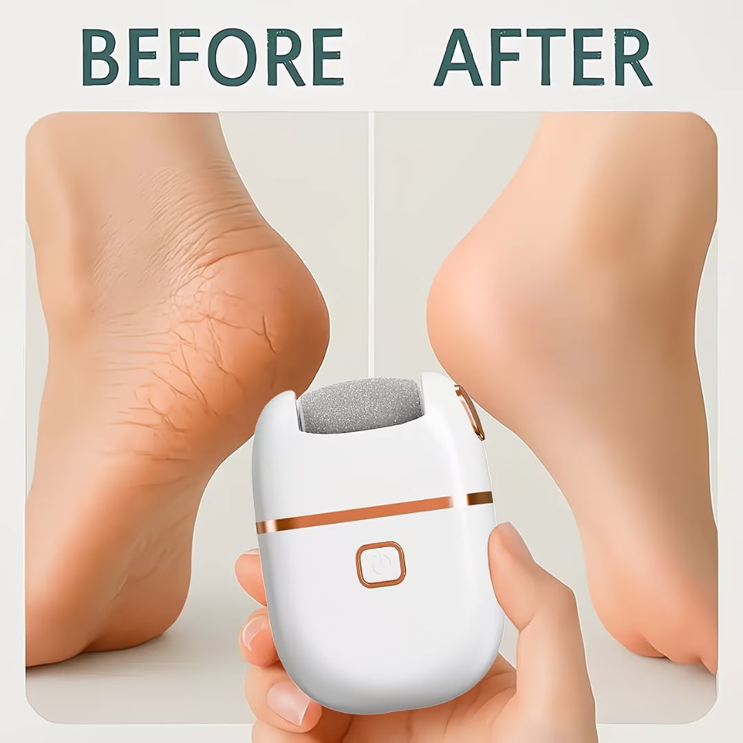 USB Powered Electric Foot Scrubber With 1 Replacement And 2 Speed Settings